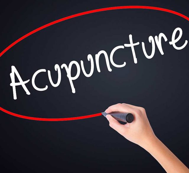 Acupunture Physiotherapy
