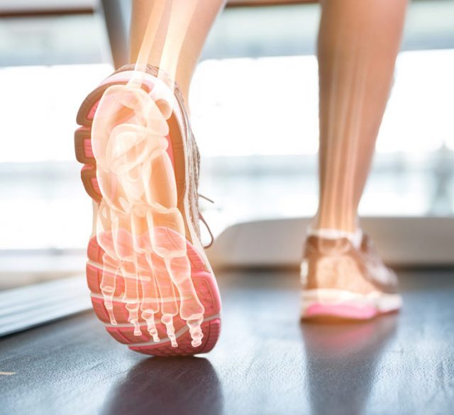 Plantar fasciitis treatment chelmsford