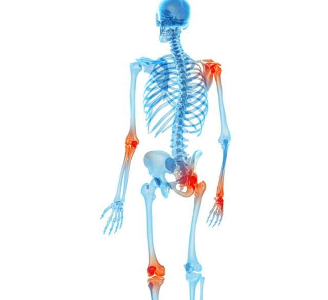 Aches and Pains