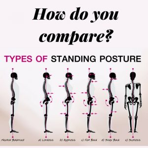 Biomechanics of different standing positions