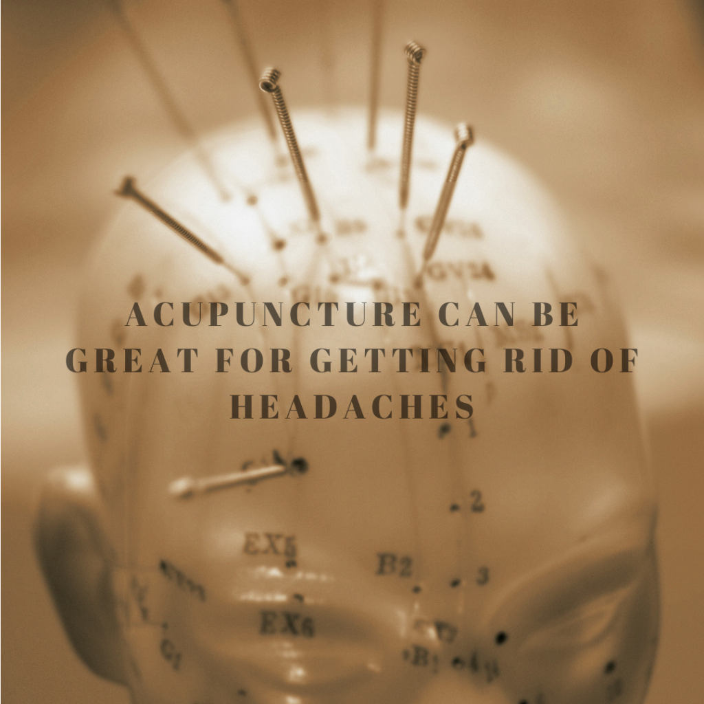 Acupuncture is great for reducing symptoms of headaches