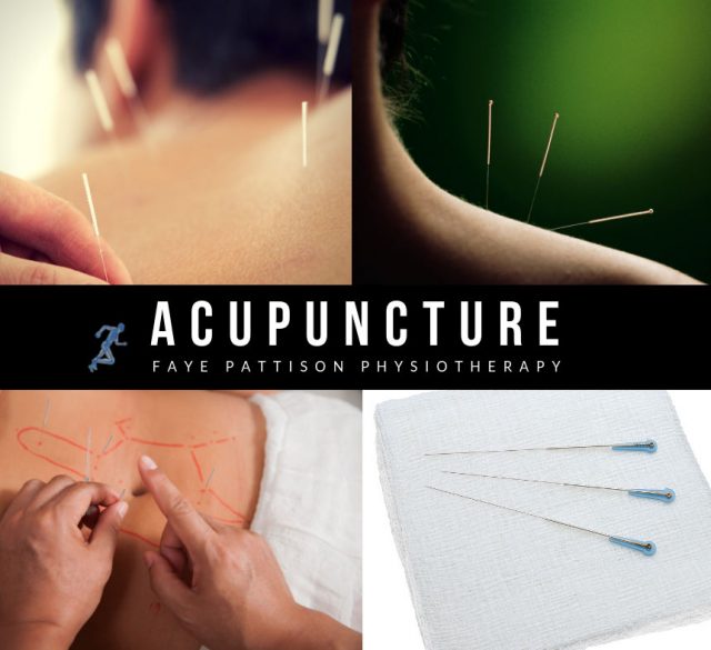 Chelmsford Acupuncture